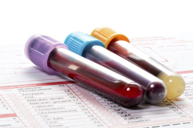 Blood test, blood samples on a laboratory form