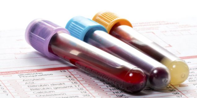 Blood test, blood samples on a laboratory form